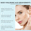 B5 Hyaluronic Acid Essence for Skin Firming and Hydration