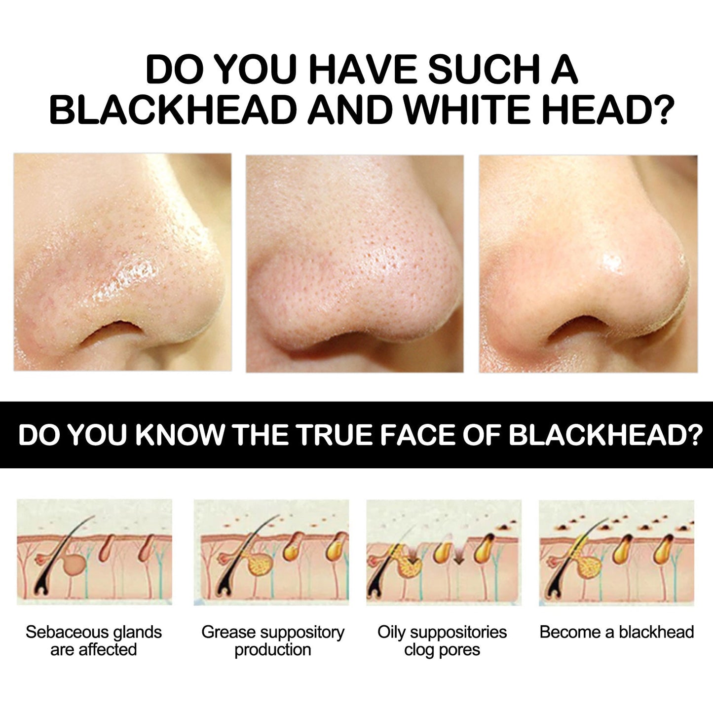 Bamboo Charcoal Facial Mask for Blackhead Removal and Pore Control