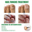 Solution de réparation des ongles avec essence d'huile d'arbre à thé