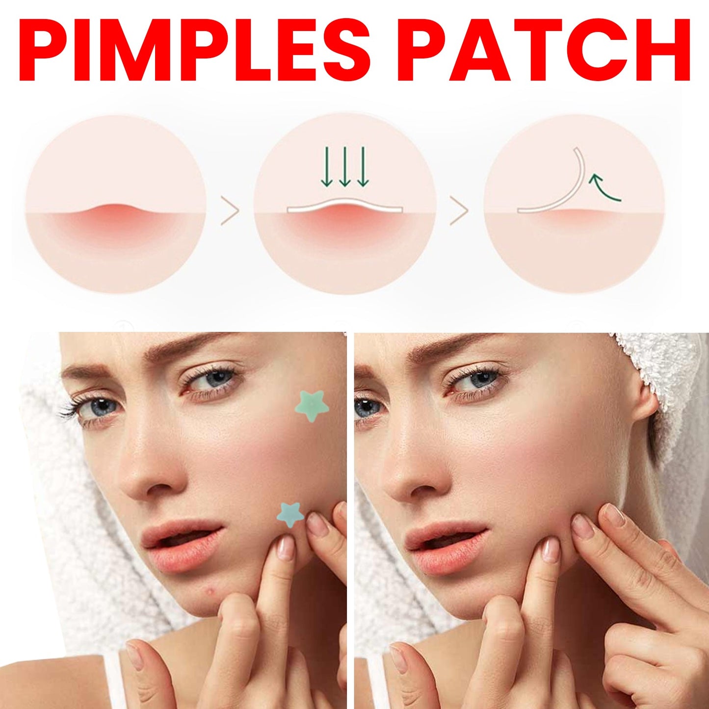 Pimple Patch for Blemish Coverage and Skin Repair