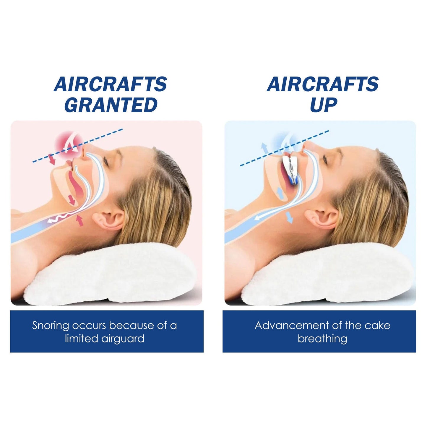 Dispositif anti-ronflement réglable pour un sommeil confortable