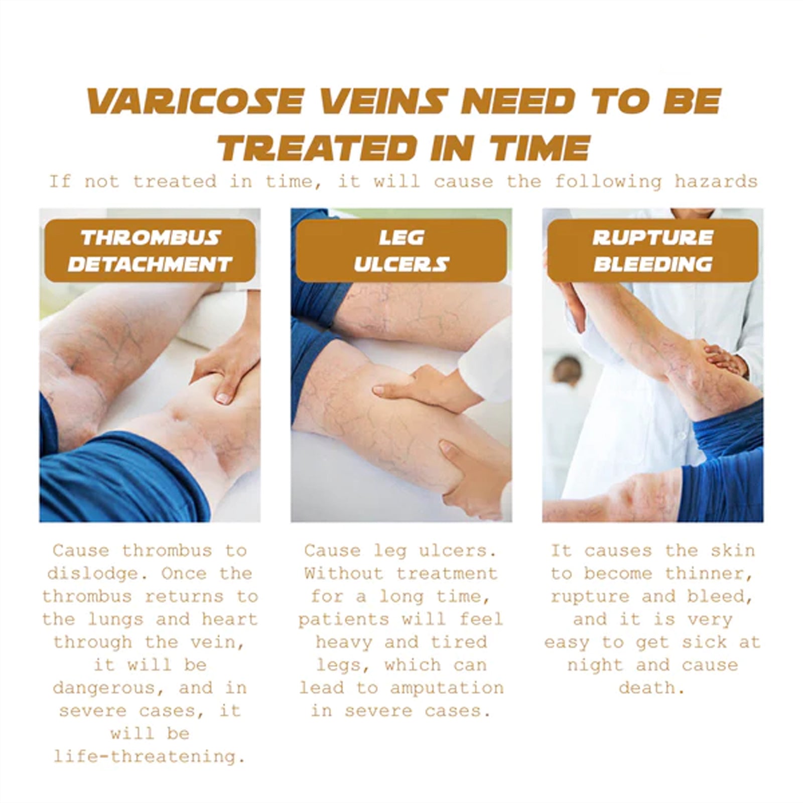 Vein Renewal Smooth Legs Cream, Relief Sore Legs Massage Varicose Earthworm Leg Vein Care Cream - Korvel