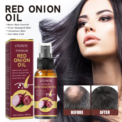 Onion Hair Growth Essential Oil, Strengthens And Hydrates Hair Growth Hair Dense Hair Care Spray - Korvel