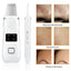 Ultrasonic Peeling Machine HailiCare Positive And Negative Ions Red And Blue Light To Remove Blackheads And Acne Beauty Instrument - Korvel