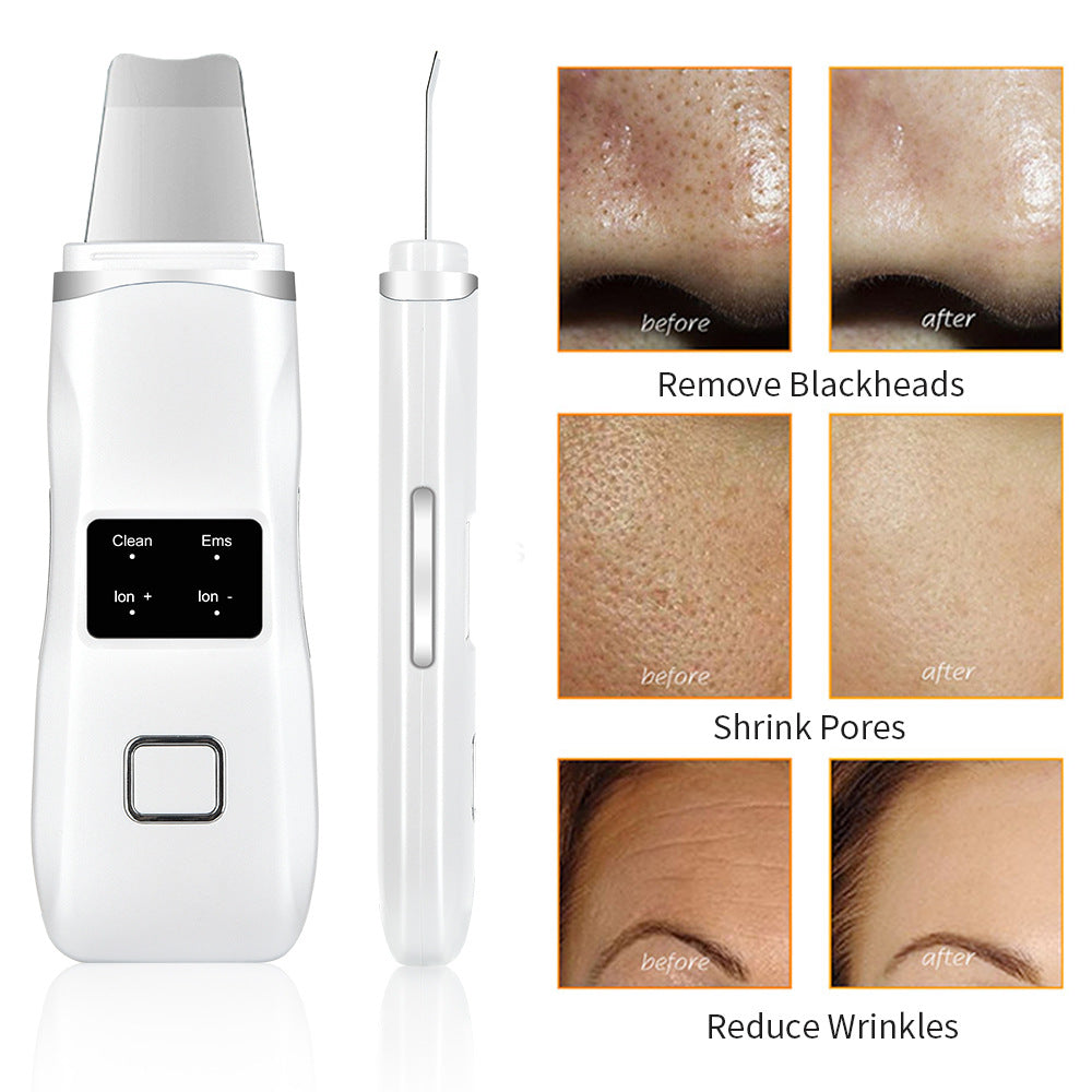 Ultrasonic Peeling Machine HailiCare Positive And Negative Ions Red And Blue Light To Remove Blackheads And Acne Beauty Instrument - Korvel