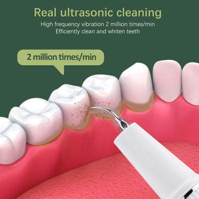 3-Speed Visible Ultrasonic Electric Tooth Cleaner Tooth Cleaning Beauty Instrument To Remove Tartar And Calculus Tooth Cleaning Device - Korvel