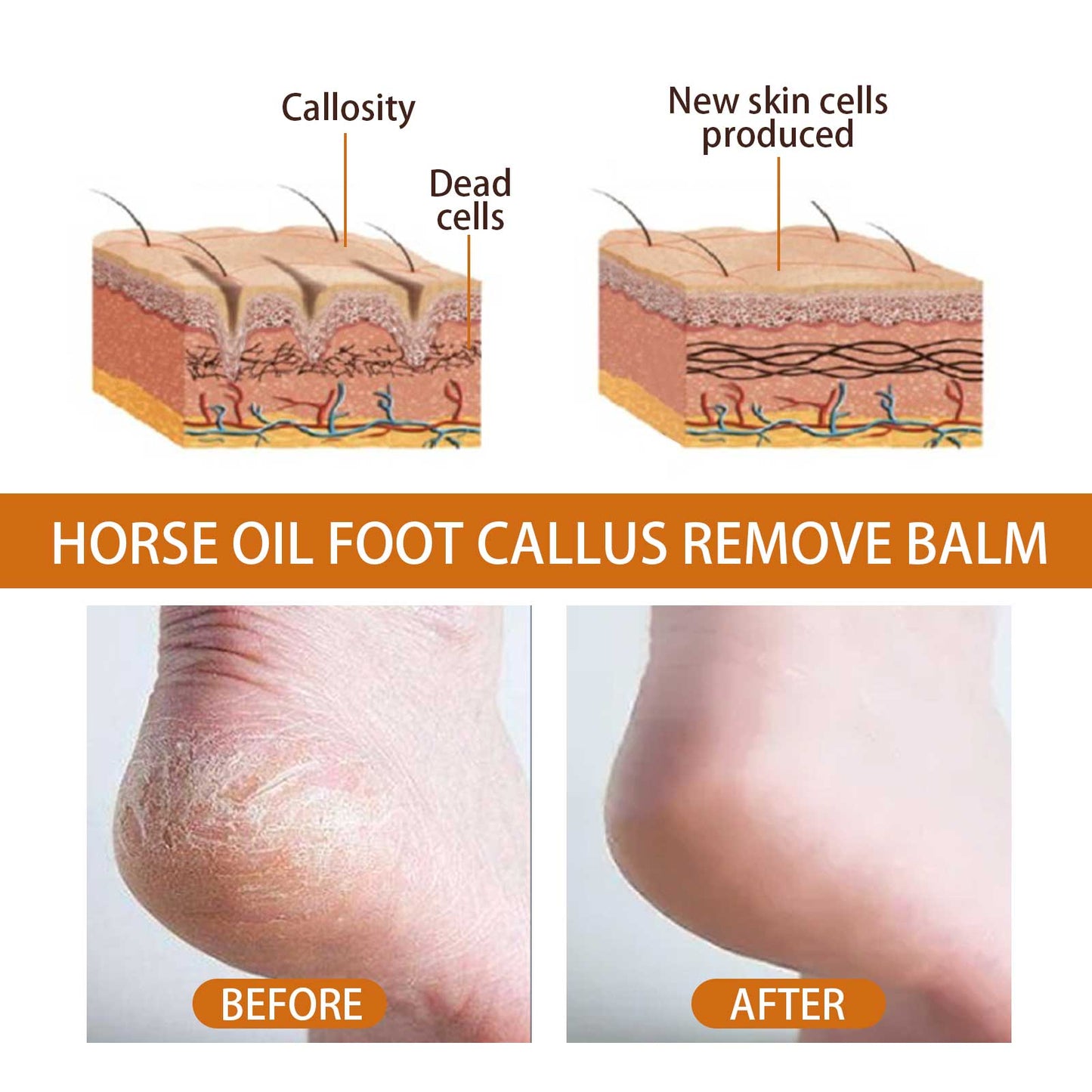 Moisturizing Foot Spray for Soft, Smooth Skin