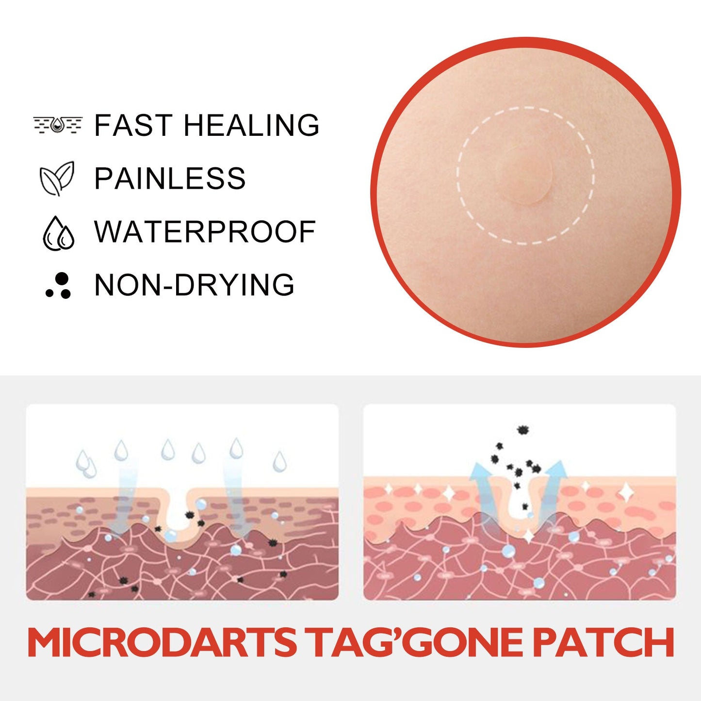 Acne Patch, Skin Clean Acne Pimple Moles Gram Wart Corns Spot Patch - Korvel