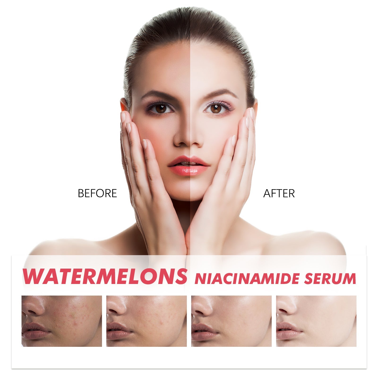 Watermelons Niacinamide Serum, Dilute Spots Firming Haun White Skin Hydrating Moisture Essence - Korvel