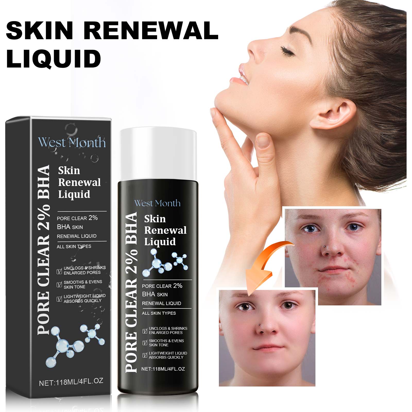 Skin Renewal Liquid, Reduce Acne Print Repair Acne Muscle Mild Clear Acne Hydrating Essence - Korvel