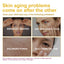 Retinol Anti-Wrinkle Serum, Reduce Facial Wrinkles And Fine Lines By Moisturizing And Firming Anti-Aging Essence - Korvel