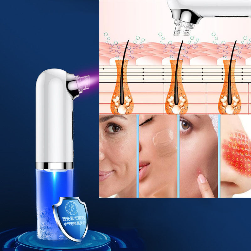 Small Bubble Beauty Instrument Household Pore Cleaning Oxygen Injection Instrument Electric Blackhead Suction Instrument - Korvel