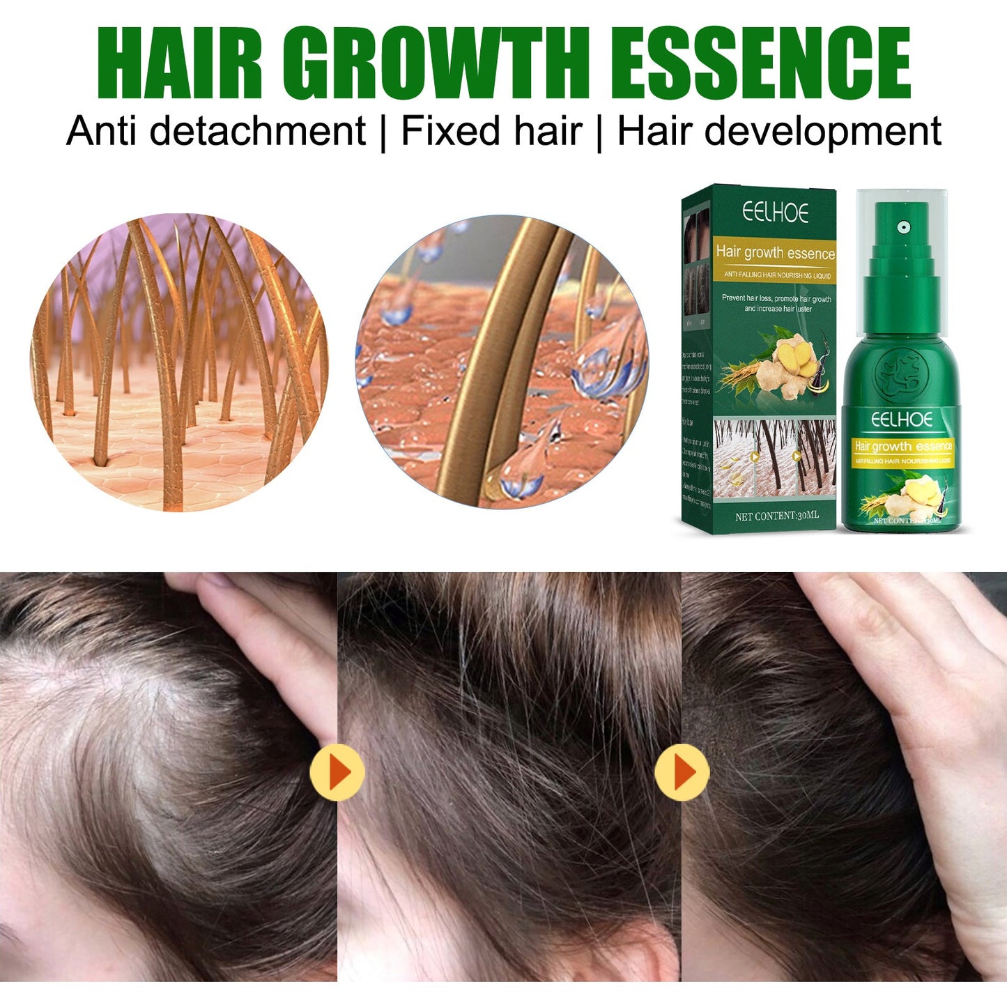 Spray de Croissance Capillaire au Gingembre - Solution Nourrissante pour les Cheveux