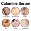 Calamine Serum, Improve Skin Dry Dull Acne Muscle Acne Hydrating Plump - Korvel