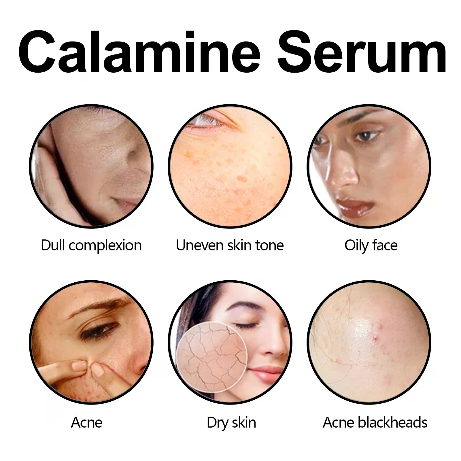 Calamine Serum, Improve Skin Dry Dull Acne Muscle Acne Hydrating Plump - Korvel