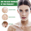 White Spot Repair Cream Skin White Spot Melanin Repair Even Skin Tone Topical Care Cream - Korvel