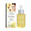 Orchid Acne Essential Oil Cleans And Brightens Pores And Hydrates Facial Care Essence - Korvel