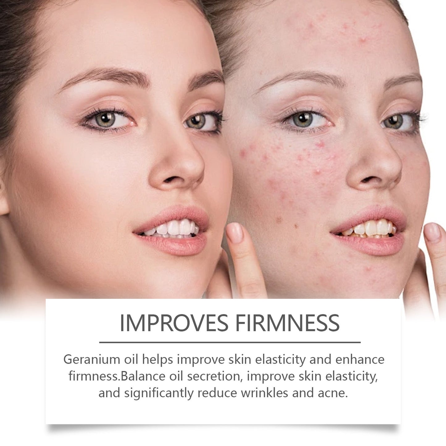 Retinol Essence Oil, Repair Facial Acne Skin Nourishing Elastic Hydrating Moisturizing Skin Care Essence - Korvel