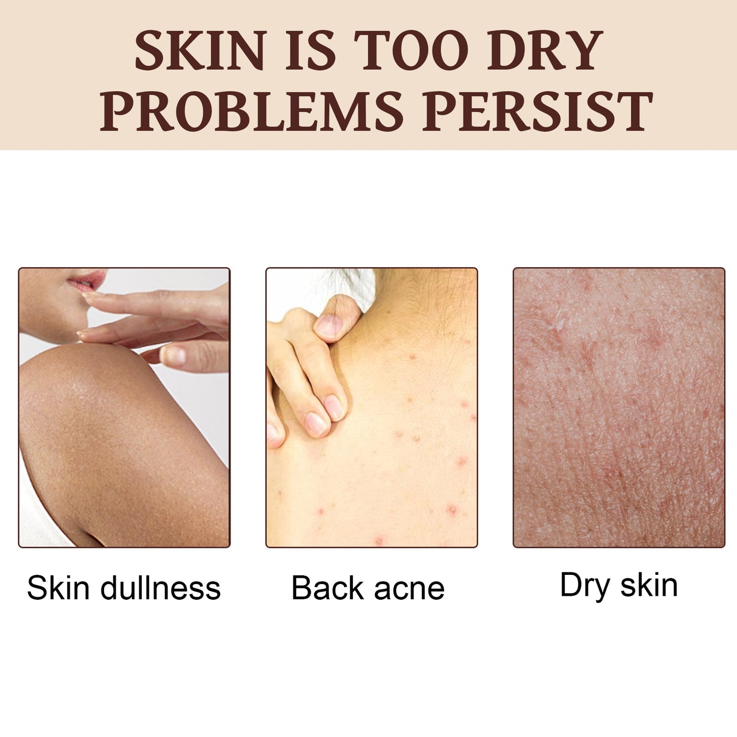 Coffee Anti-Wrinkle Body Lotion Refreshing, Delicate, Brightening And Repairing Dry Skin Body Lotion - Korvel