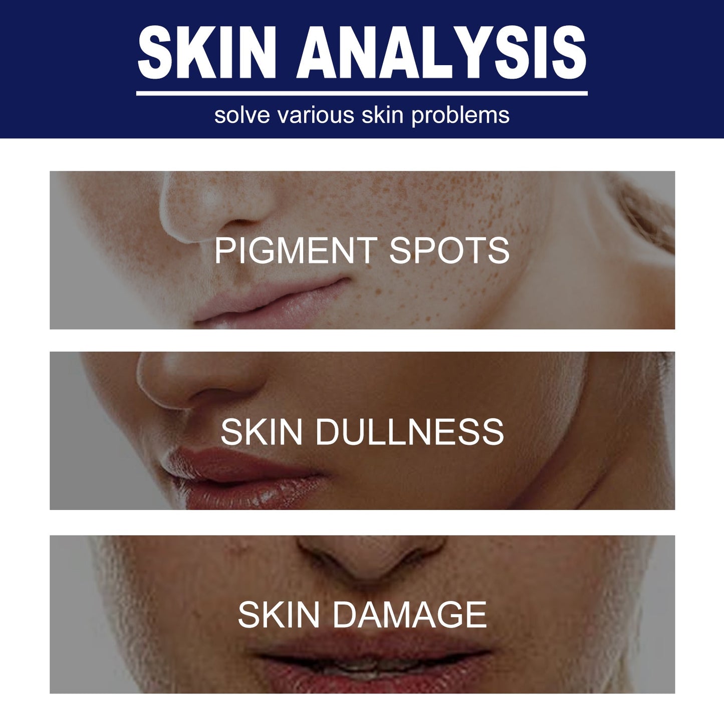 Crema Aclaradora de Manchas Skin Genesis