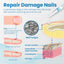 Anti-Paronychia Nail Repairing Gel, Repair Encased Rotten Nails Soft Nails Thickening Pain Relief Cleansing Care - Korvel