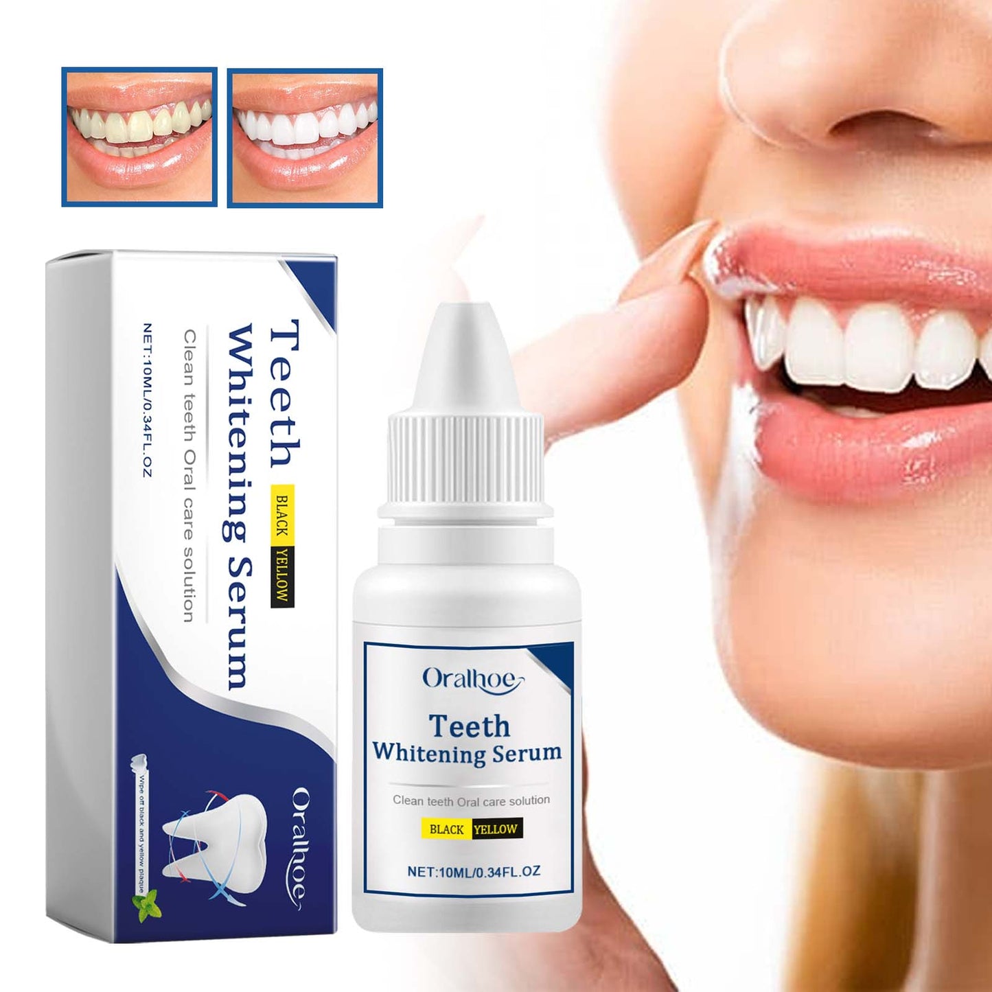 Premium Teeth Whitening Serum for a Radiant Smile