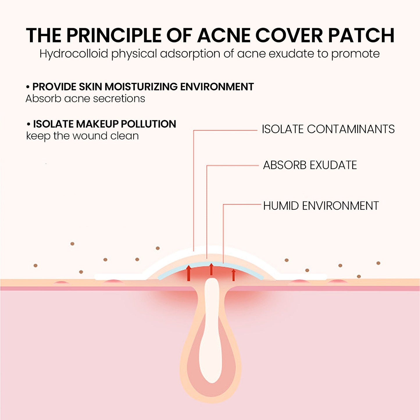 Pimples Patch, Mild Non-Irritant Lightening Pimples Spot Pimples Mark Covering Acne Pimples Patch - Korvel