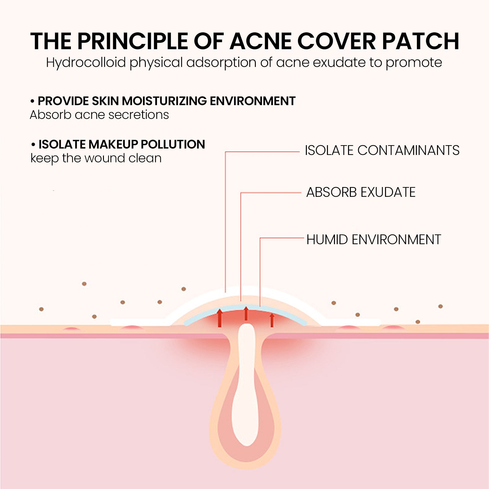 Pimples Patch, Mild Non-Irritant Lightening Pimples Spot Pimples Mark Covering Acne Pimples Patch - Korvel