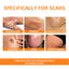 Skin Repair Pen For Reducing Pregnancy Burns Scars And Smoothing The Skin - Korvel