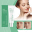 Azelaic Acid Essence Cream, Repair Moisturizing Moisturizing Face Oil Control Moisturizing Mild Refreshing Cream - Korvel