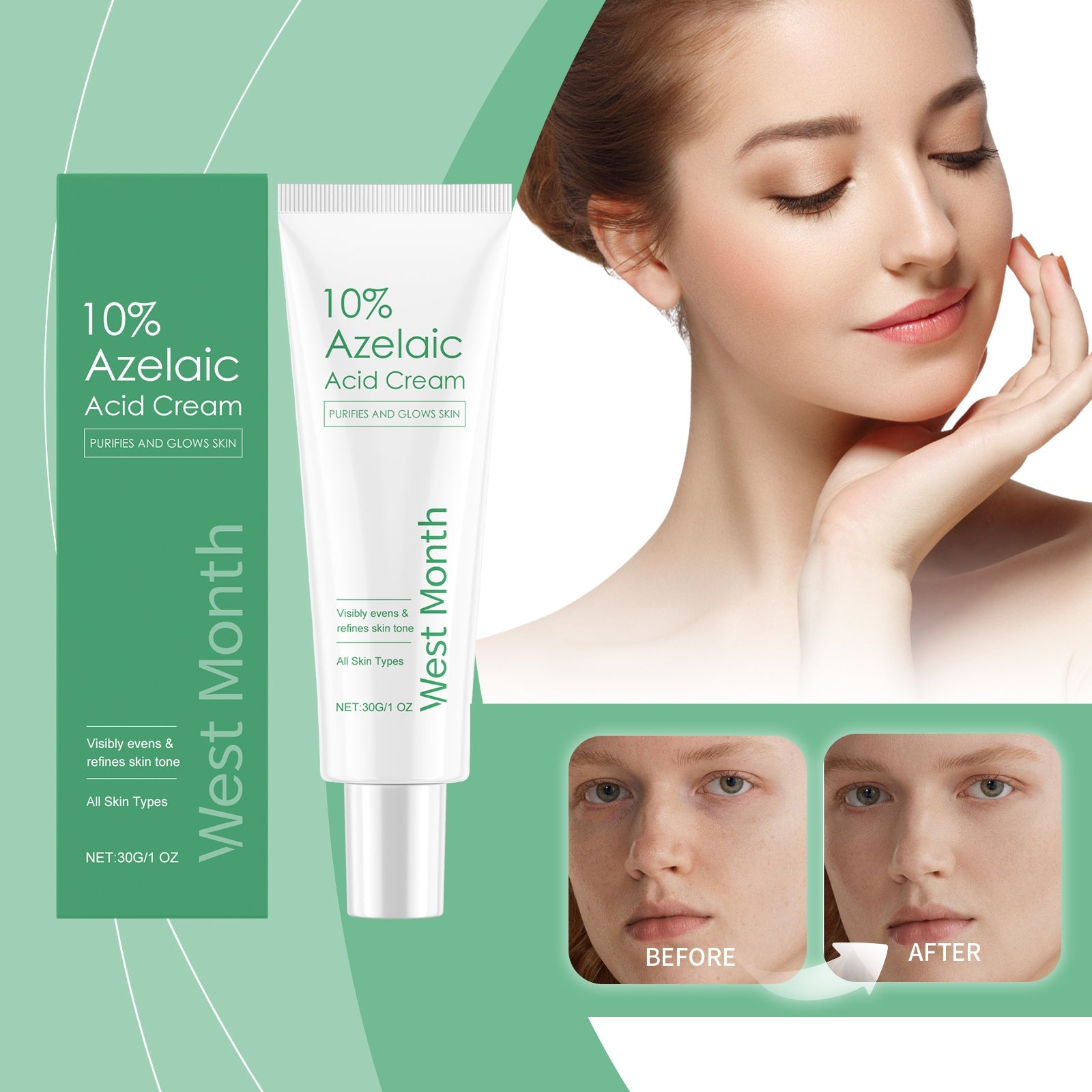 Azelaic Acid Essence Cream, Repair Moisturizing Moisturizing Face Oil Control Moisturizing Mild Refreshing Cream - Korvel