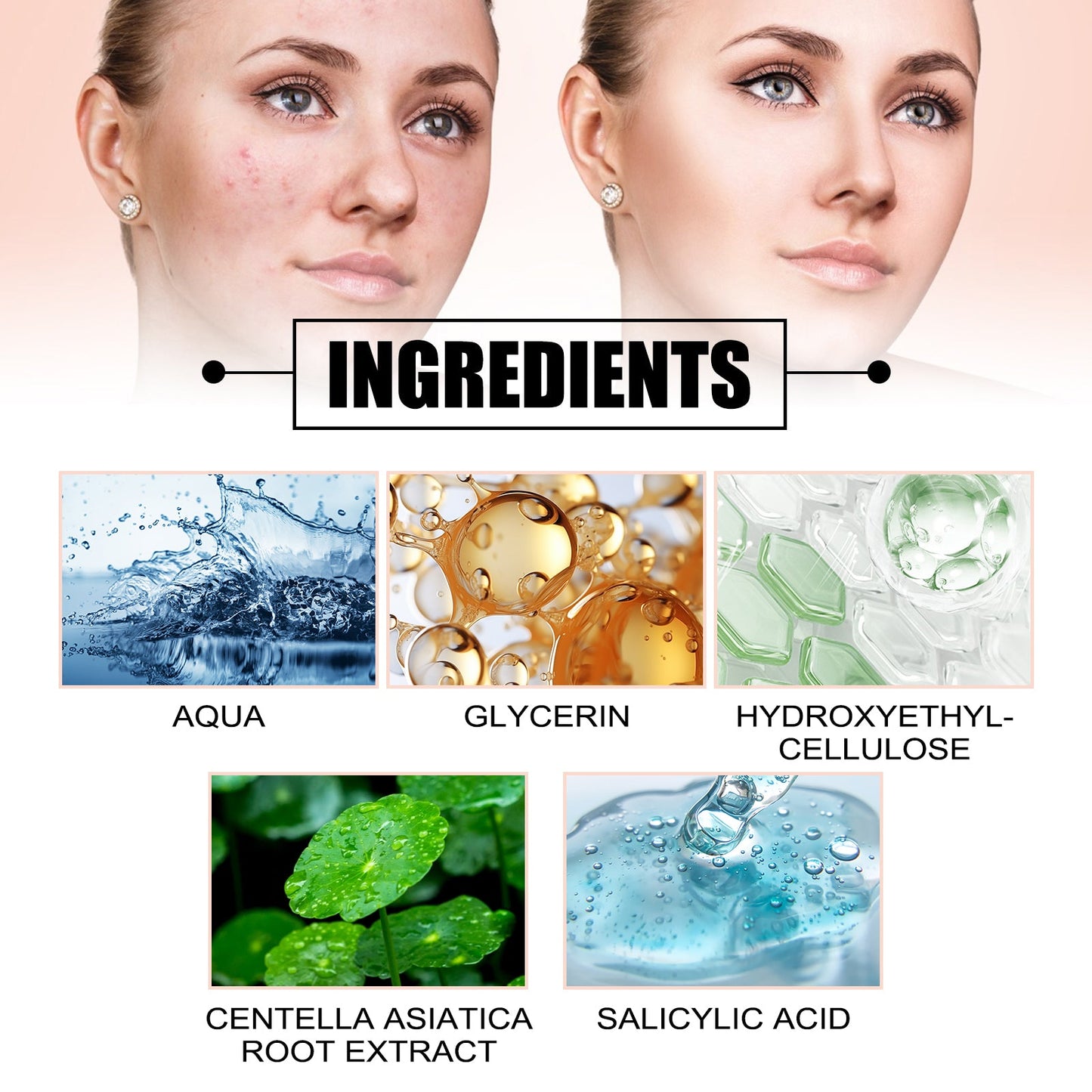 Invisible Acne Defense Patch - Color Profile Shaped