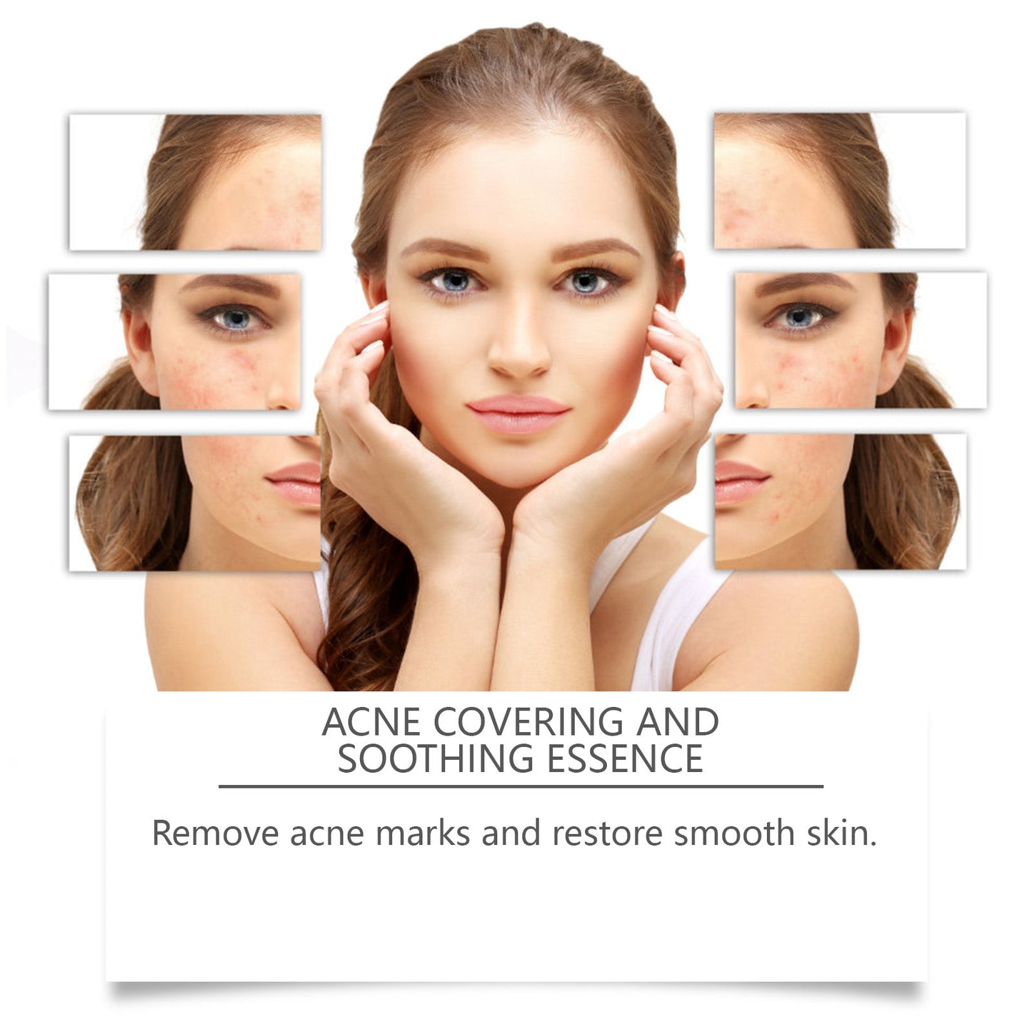 Acne Soothing Serum Facial Skin Hydrating And Moisturizing Pitted And Pimple Mild Care Solution - Korvel