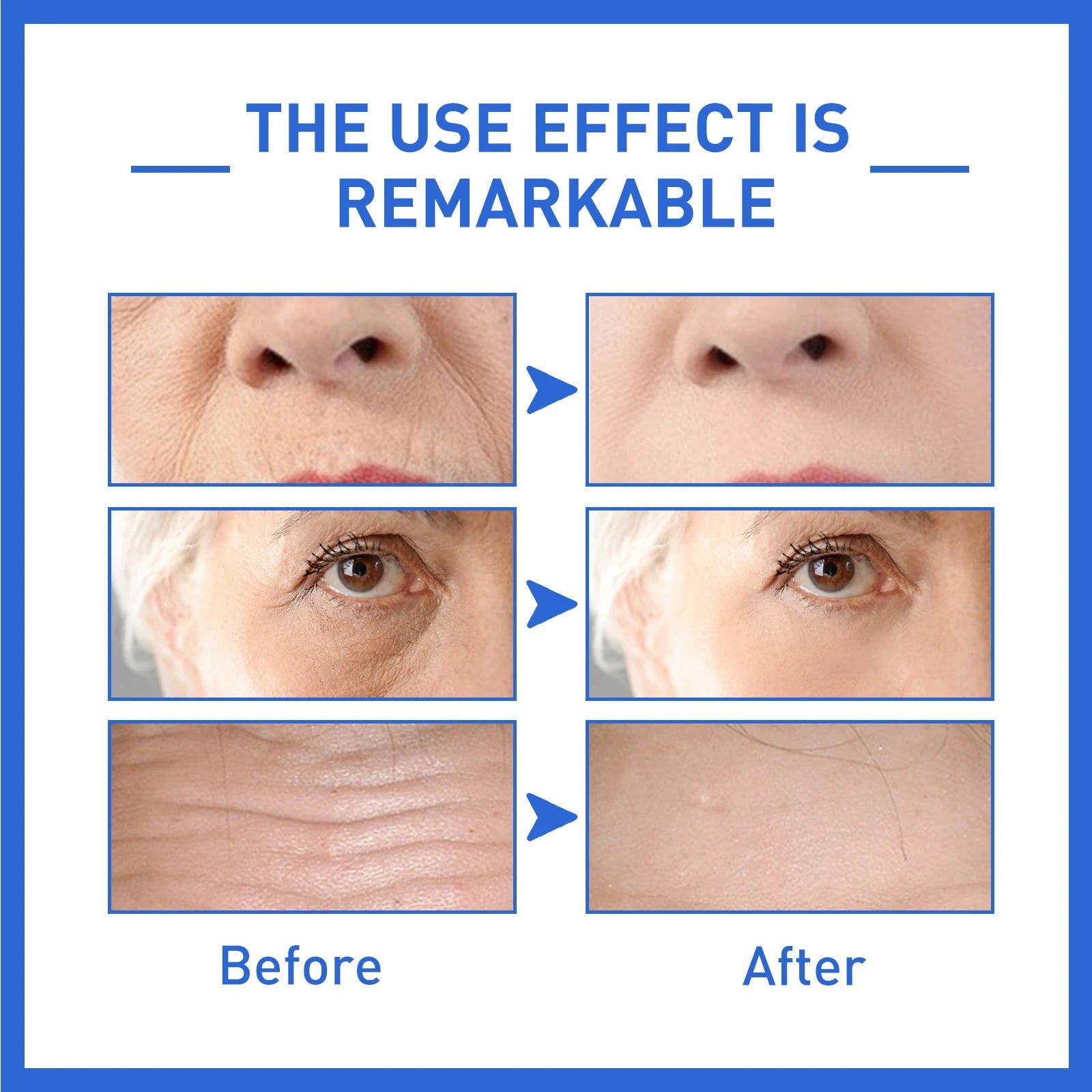Anti-Aging Collagen Serum with Nicotinamide, Vitamin C, Hyaluronic Acid - Reduce Dark Spots, Cleanse & Tighten Skin - Korvel