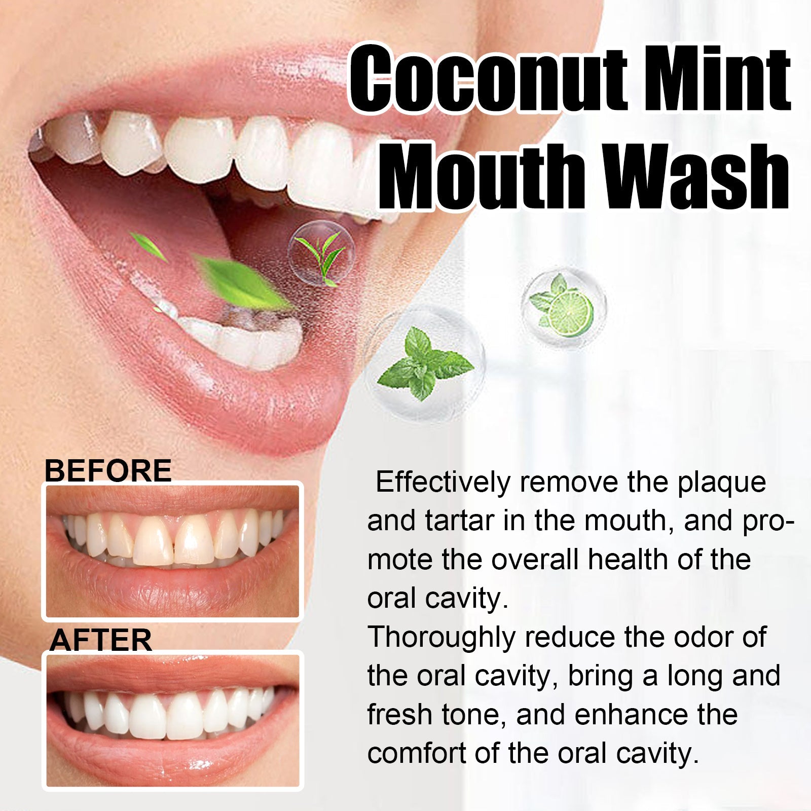 Teeth Rinse, Deep Clean Mouth Fresh, Deodorizing And Whitening Teeth Stain Removing Mouthwash - Korvel