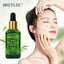 BREYLEE Acne Treatment Face Serum Mask Anti Acne Pimple Scar Remover Moisturizing Whitening Skin Care Facial Essence Cream 17ml - Korvel