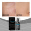 Men's Concealer Moisturizer Is A Light And Long-Lasting Moisturizing And Brightening Concealer Moisturizer - Korvel