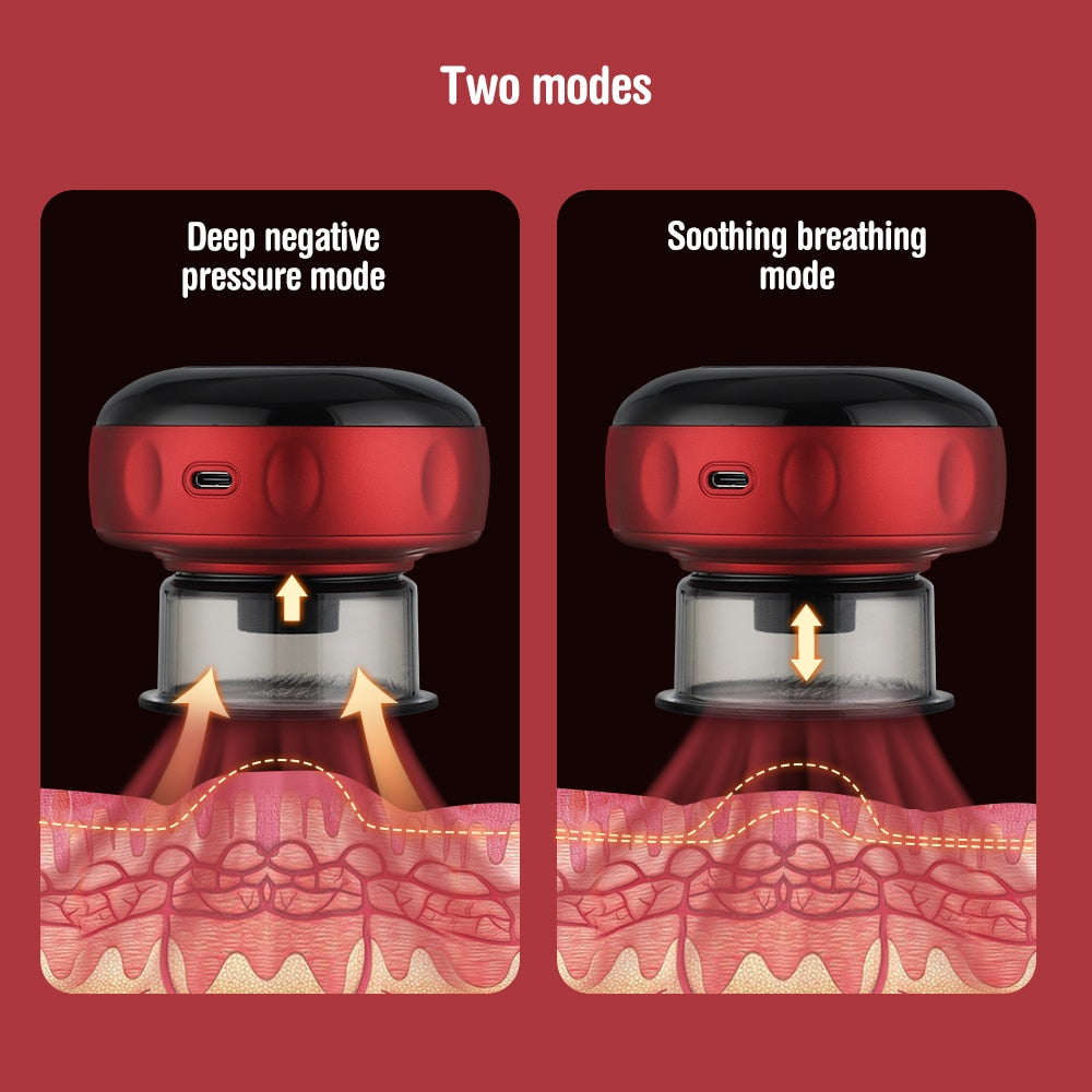 Electric Cupping Massager Scraping and Cupping Therapy Red Light Heating Vibration Pressotherapy Rechargeable Pain Relief - Korvel