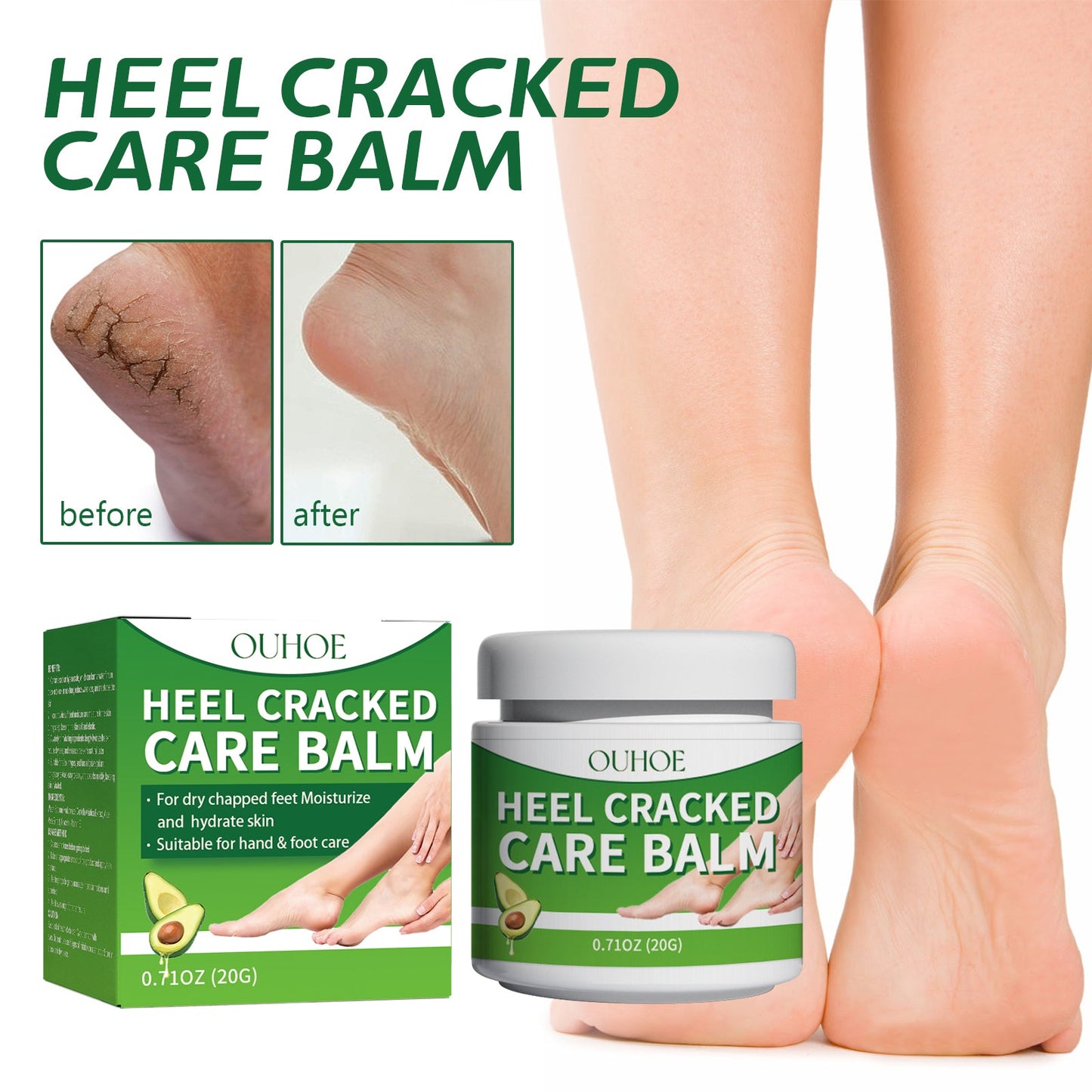 Chapped Heel Care Cream Repair Heel Peeling, Anti-Cracking And Moisturizing Foot Care Cream - Korvel