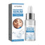 Niacinamide Serum, Lightening And Whitening Skin Moisturizing And Anti-Wrinkle Essence - Korvel