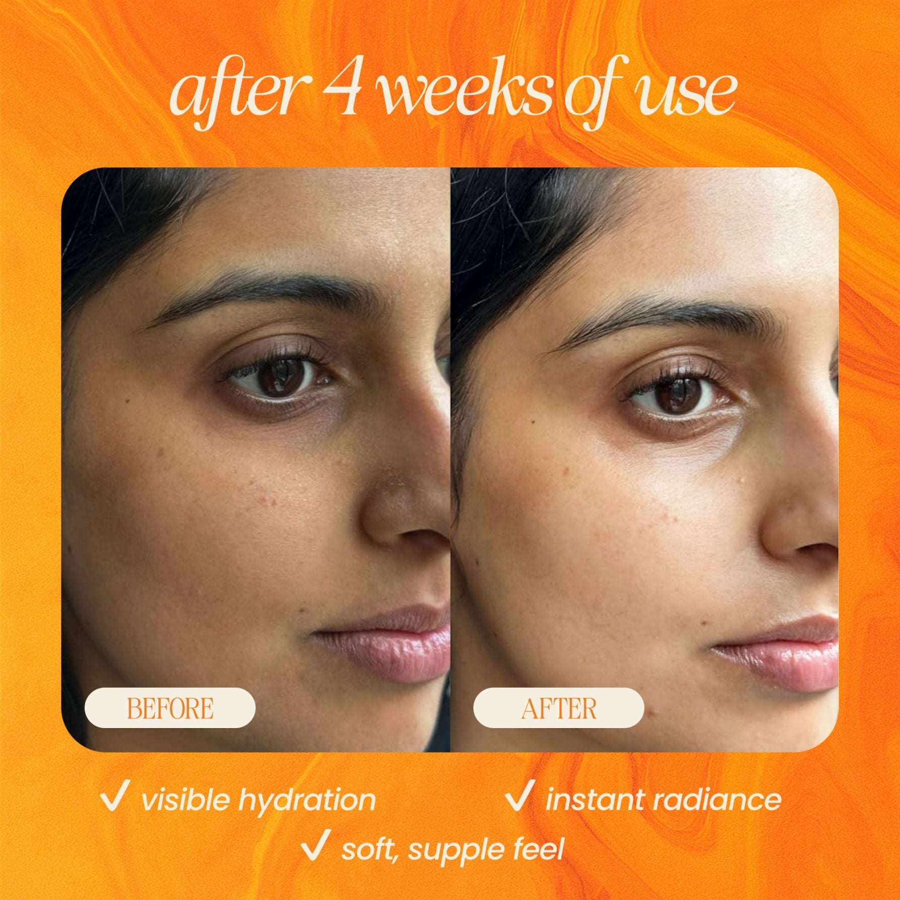 Bakuchiol Skin Renewing Facial Oil (Retinol Alternative) - Korvel