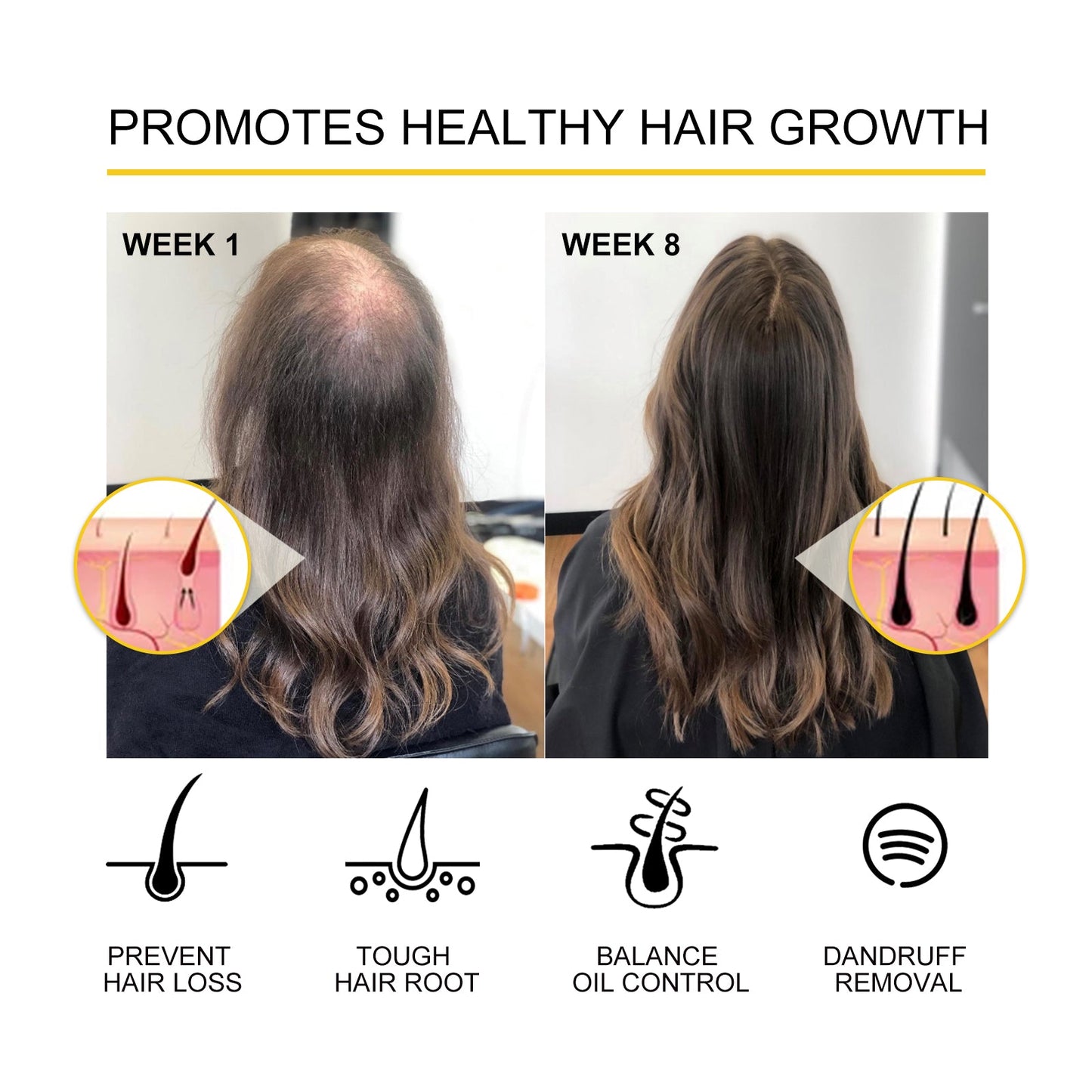 Dense Hair Essential Oil, Moisturize And Thicken Hair Repair Hair Root Damaged Hair Strong Firming Hair Care Essential Oil - Korvel