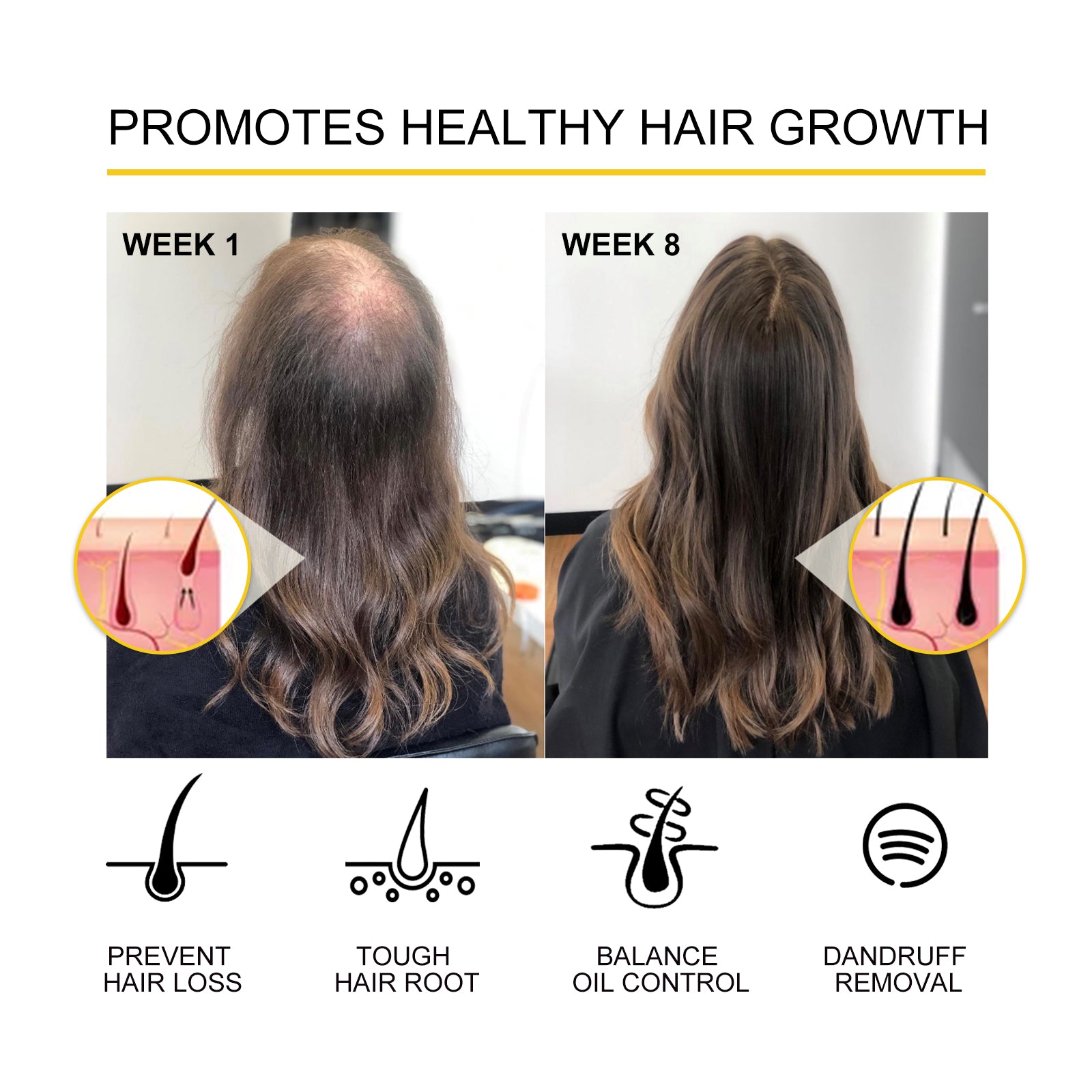 Dense Hair Essential Oil, Moisturize And Thicken Hair Repair Hair Root Damaged Hair Strong Firming Hair Care Essential Oil - Korvel