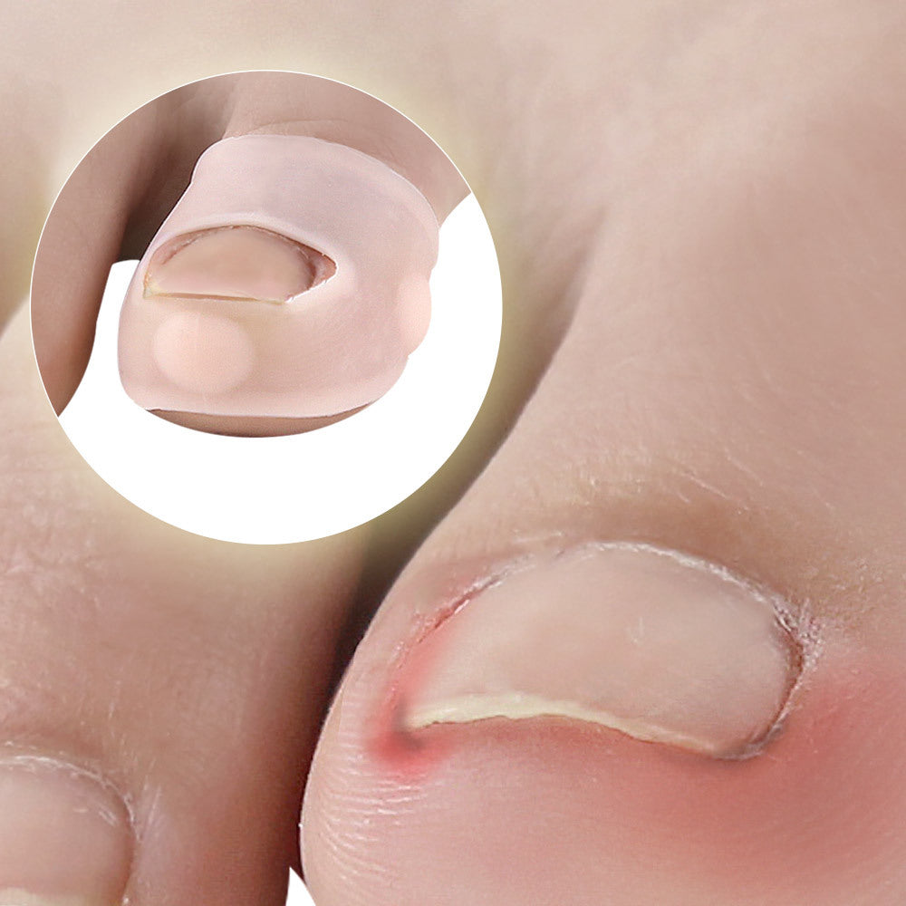 Correcteur d'ongles en silicone pour un soin confortable des pieds