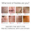 Face Brightening Serum, Lighten Dark Spots Moisturizing And Repairing Fine Lines Brightening Serum - Korvel