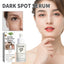 Dark Spot Serum, Fade Spot Moisturize Skin Repair Blain Mark Face Dull Shine Essence - Korvel