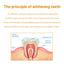 Premium Tooth Whitening Mousse for Bright, Fresh Smile