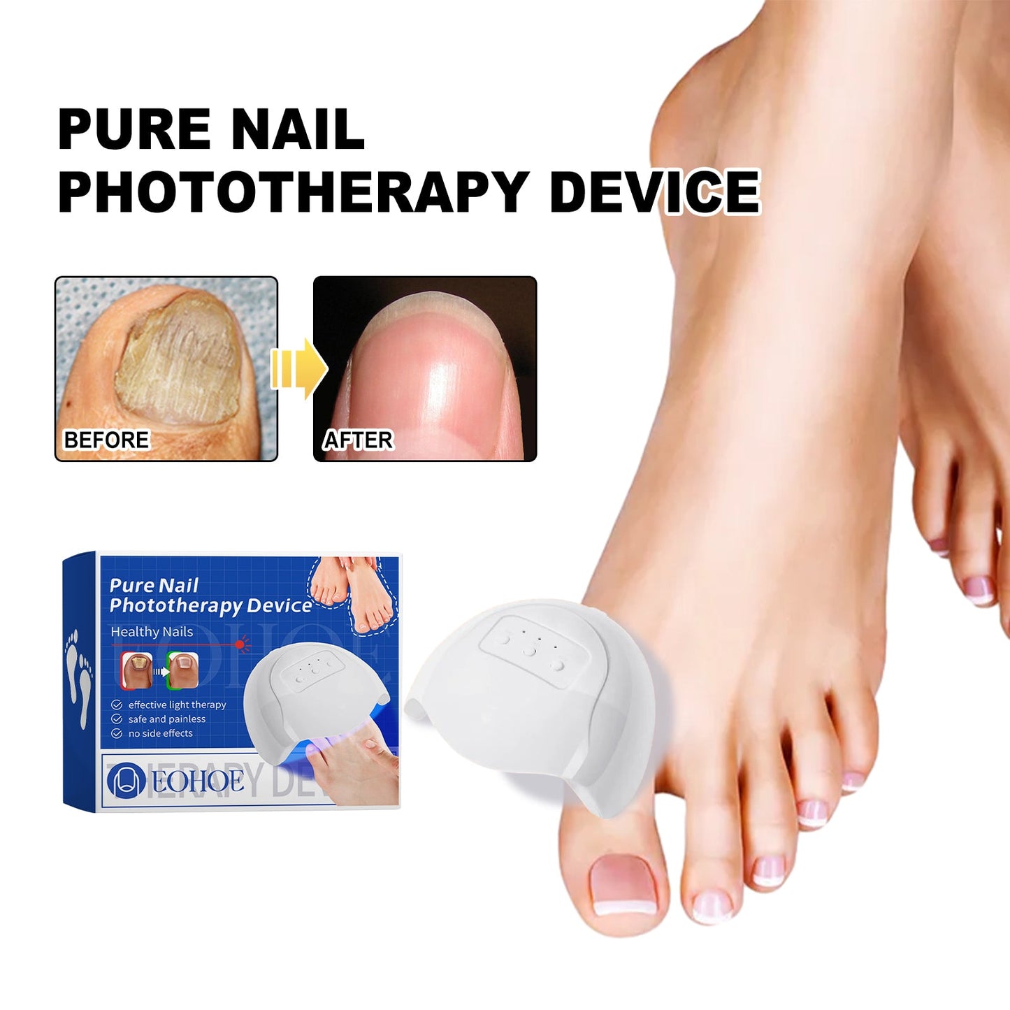 Pure Nail Phototherapy Device, Repair Broken Nails Innail Thickening Brightening Nails Gentle Cleaning Gray Nail Care - Korvel