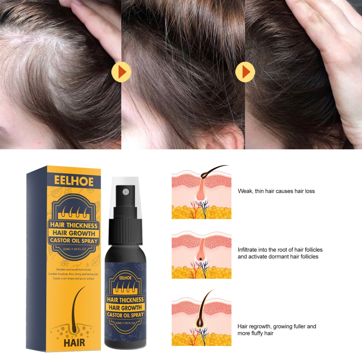 Dense Castor Oil Nutrient Solution, Hair Prevention, Moisturizing Hair Follicles Massage Repair Hair Hair - Korvel