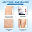 Varicose Vein Slimming Cream, Vein Repair Body Care Reduces Leg Muscle Swelling Earthworm Leg Slimming Cream - Korvel